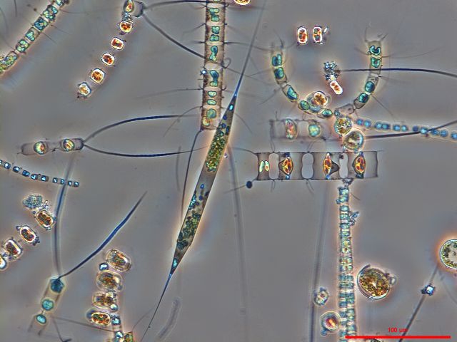 Forr�s: Karl Bruun, Nostoca Algae Laboratory/Nikon Small World